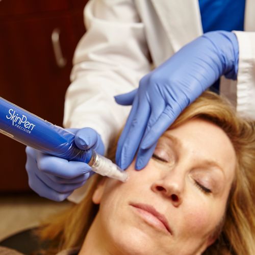 Microneedling